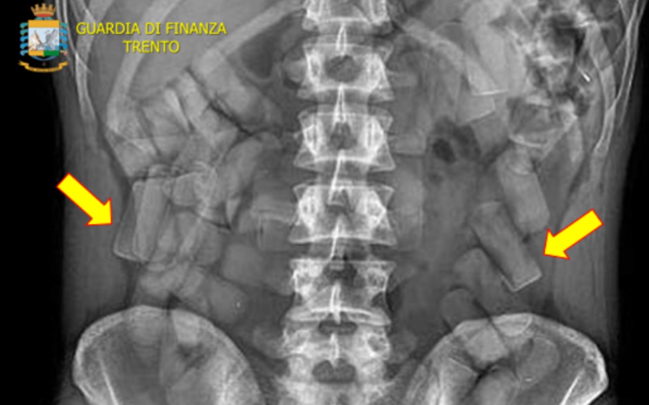 Radiografia 2 – con frecce_rsz